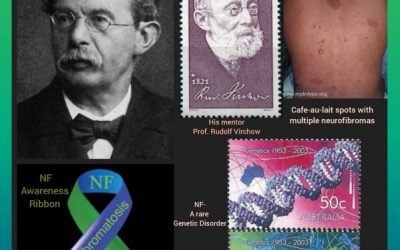 History Today in Medicine – Dr. Friedrich Daniel von Recklinghausen