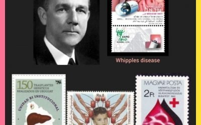 History Today in Medicine – Dr. George Whipple
