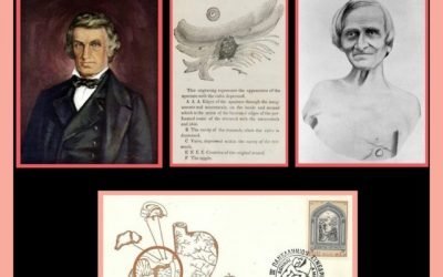 History Today in Medicine – Dr. William Beaumont
