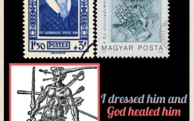 History Today in Medicine – Ambroise Pare