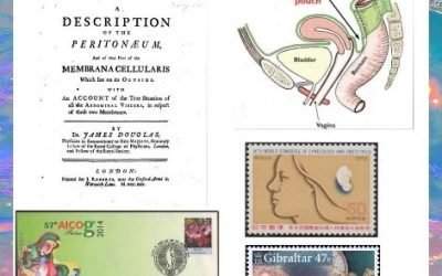 History Today in Medicine – Dr. James Douglas