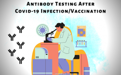 Antibody Testing After Covid-19 Infection / Vaccination