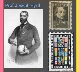 History Today in Medicine – Dr. Josef Hyrtl