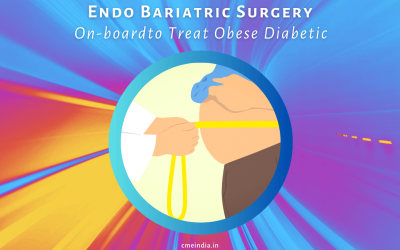 Endo Bariatric Surgery On-board to Treat Obese Diabetic