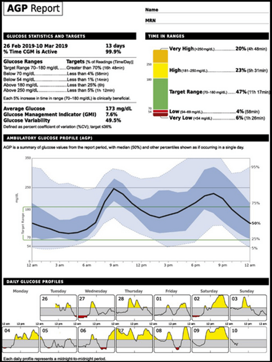 Continuous Glucose Monitoring (CGM) - What Physician Must Know?