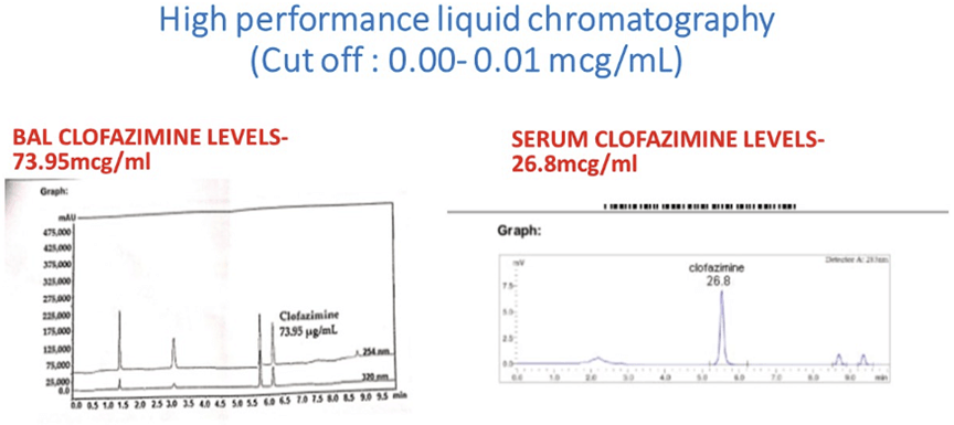 A Curious Case of Hemoptysis - Thinking Out of The Box