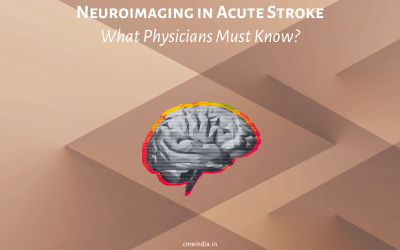 Neuroimaging in Acute Stroke – What Physicians Must Know?