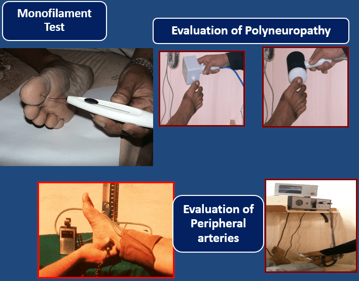What Physicians Need to Advice Patients About Diabetic Foot Care?