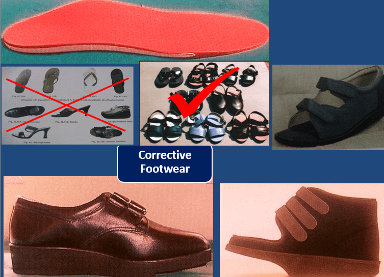 What Physicians Need to Advice Patients About Diabetic Foot Care?