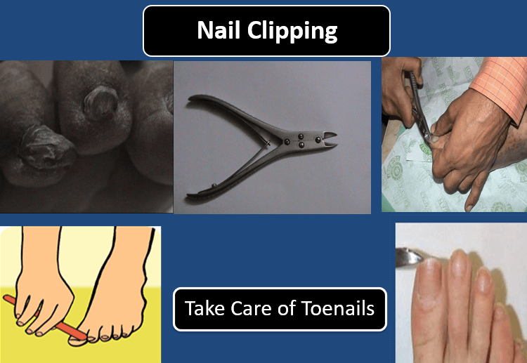 What Physicians Need to Advice Patients About Diabetic Foot Care?