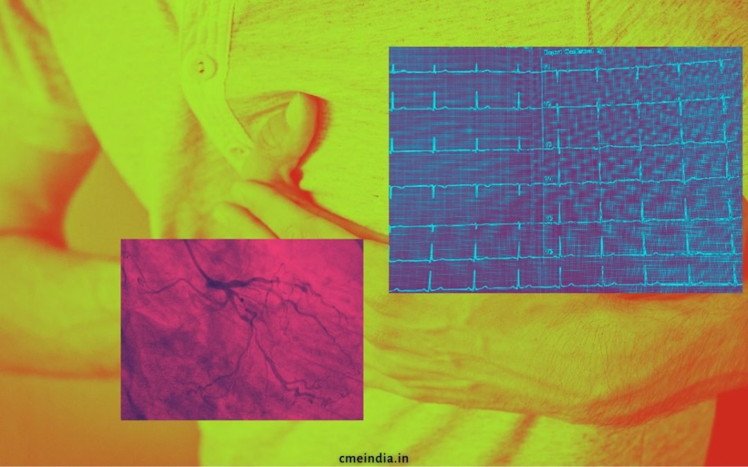 Puzzle: 42-Yr.-Old Male Patient with Left Sided Chest Pain of 1 Day Duration