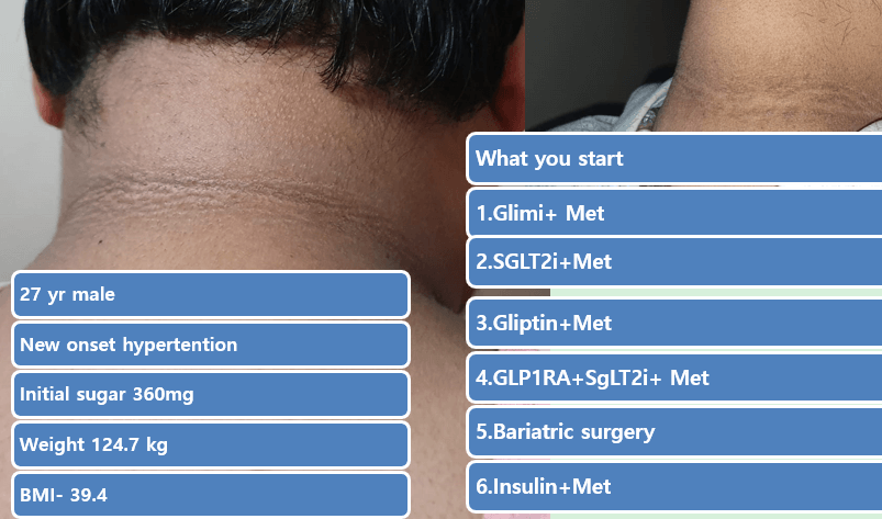 Atypical Diabetes, Why Do We Miss It?