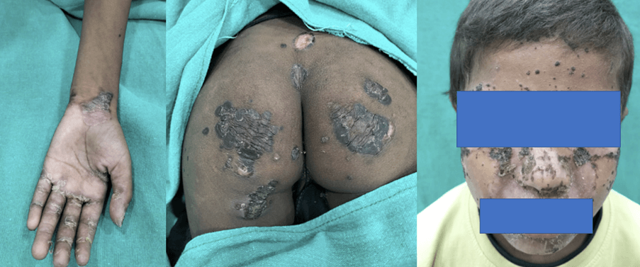 Dermatology is all about pictures and visuals: Diagnose the Challenge