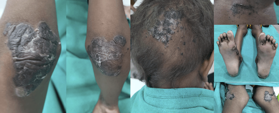 Dermatology is all about pictures and visuals: Diagnose the Challenge