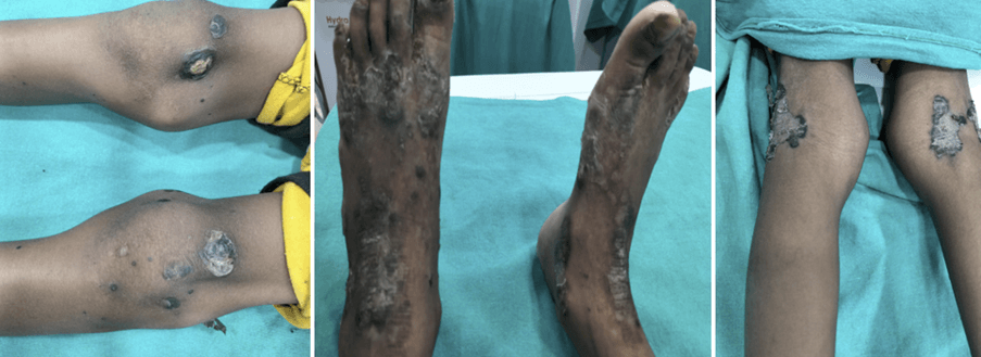 Dermatology is all about pictures and visuals: Diagnose the Challenge