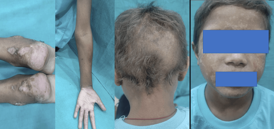 Dermatology is all about pictures and visuals: Diagnose the Challenge