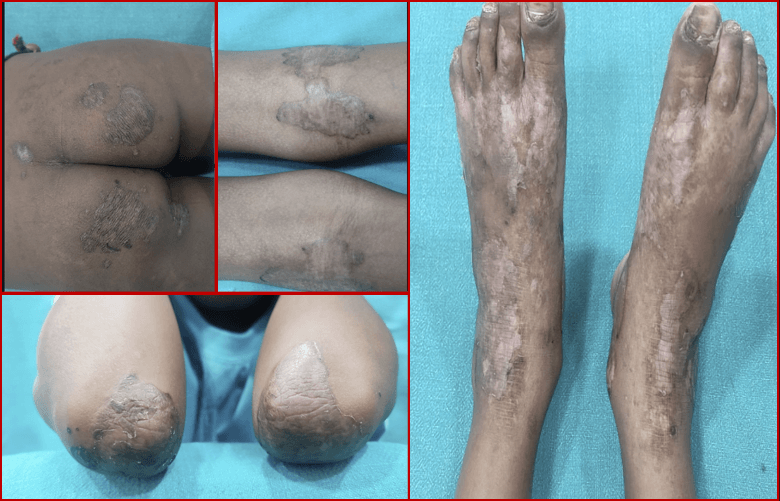 Dermatology is all about pictures and visuals: Diagnose the Challenge