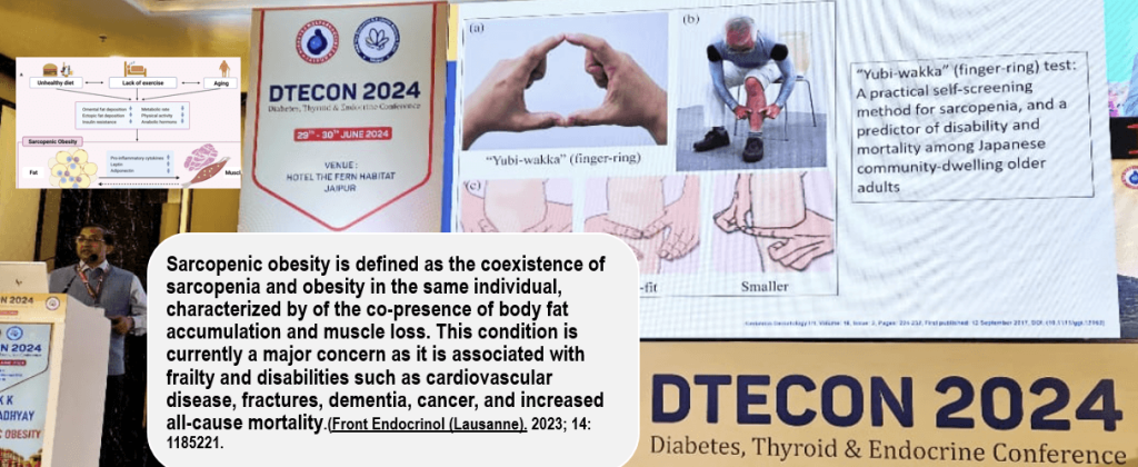 Sarcopenic Obesity: Simplified