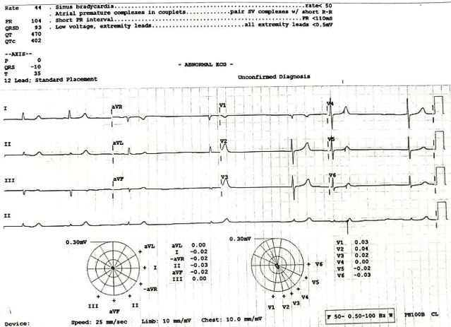 When Condition Suddenly Deteriorated on 3rd Postoperative Day