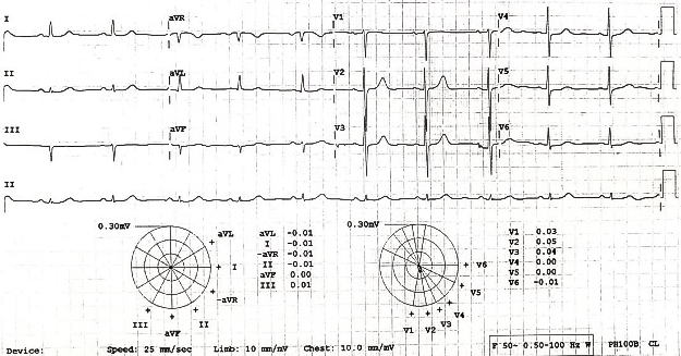 When Condition Suddenly Deteriorated on 3rd Postoperative Day