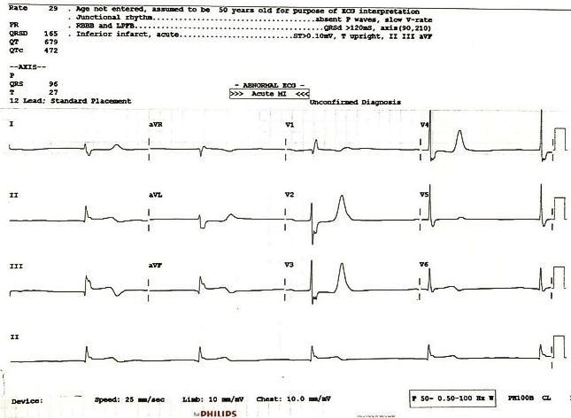 When Condition Suddenly Deteriorated on 3rd Postoperative Day