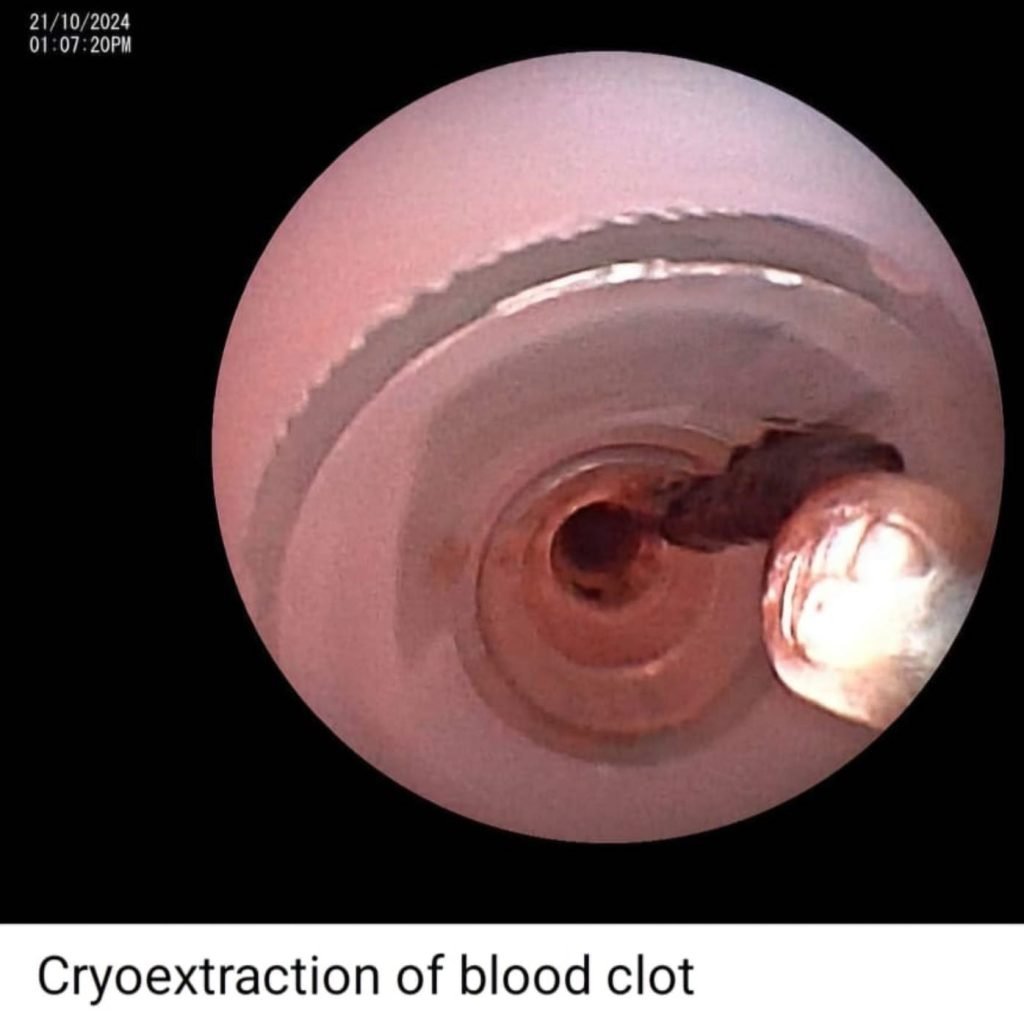 There is always a way; if there isn't, make one! - IP (Interstitial Pulmonary diseases) beyond barriers