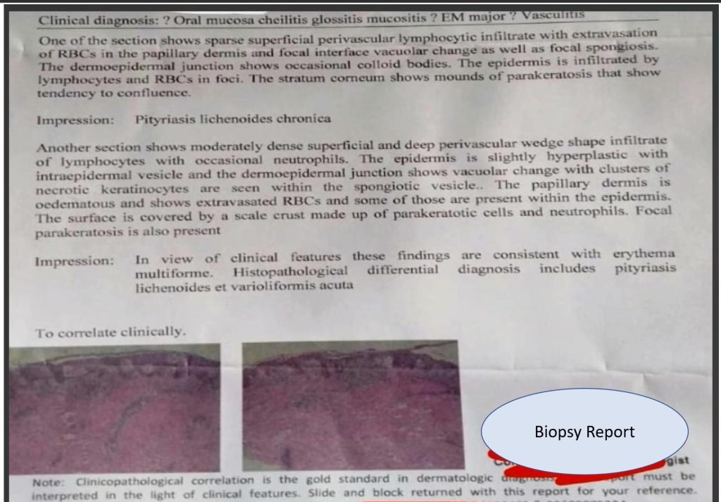 22-year-old male with a sudden onset of fever and petechial skin lesion