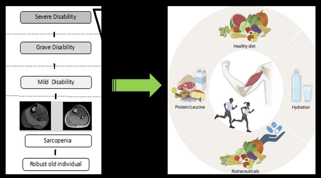 How to fight Sarcopenia while being older?