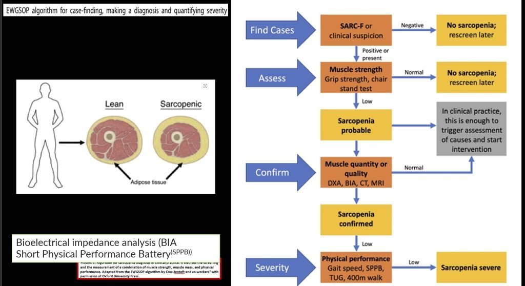 How to fight Sarcopenia while being older?