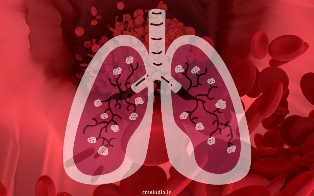 Tetralogy Of Fallot with Pulmonary Hyperemia