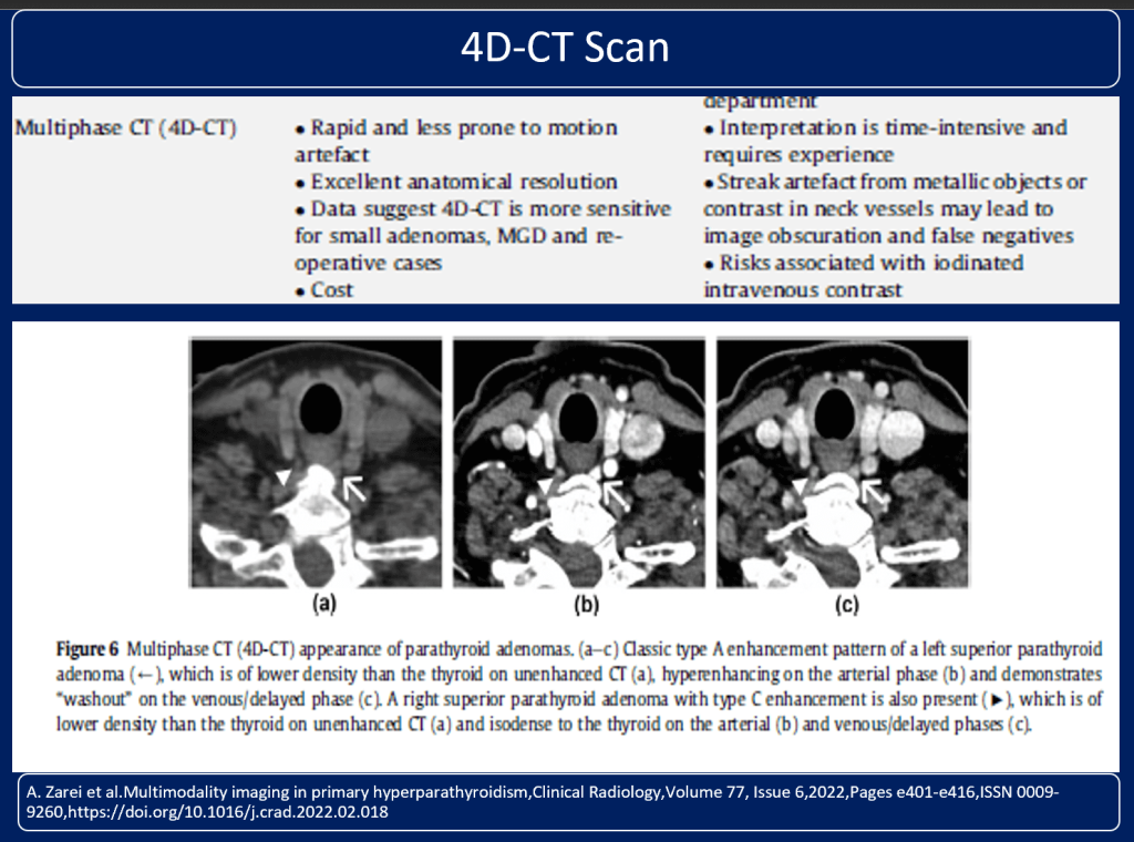 What Physicians Must Know about Approach to Recurrent Renal Calculi
