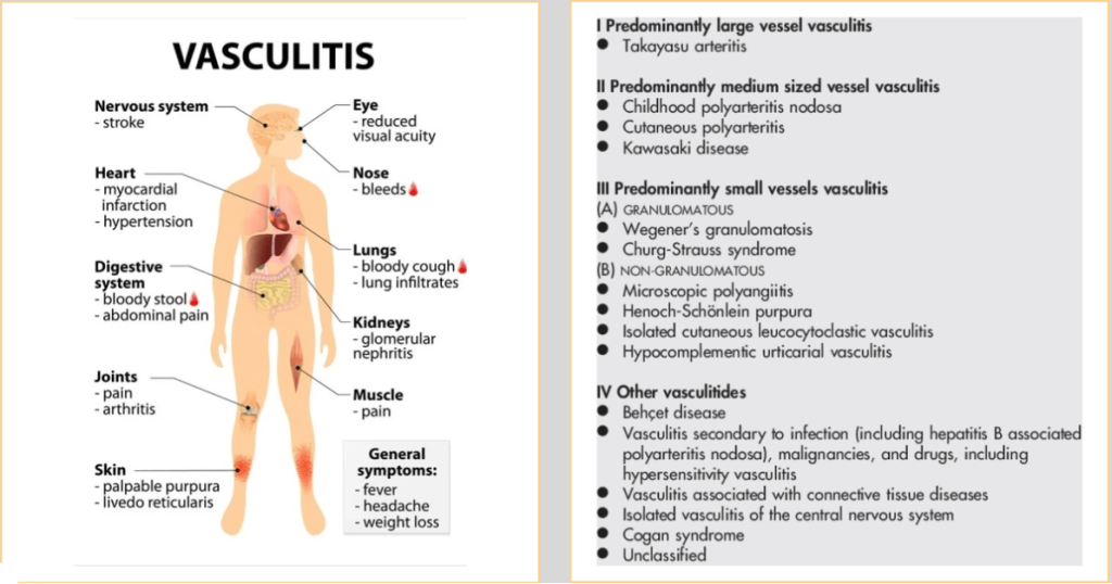 Clinical Practice Pearls Physicians Need To Know In Rheumatology