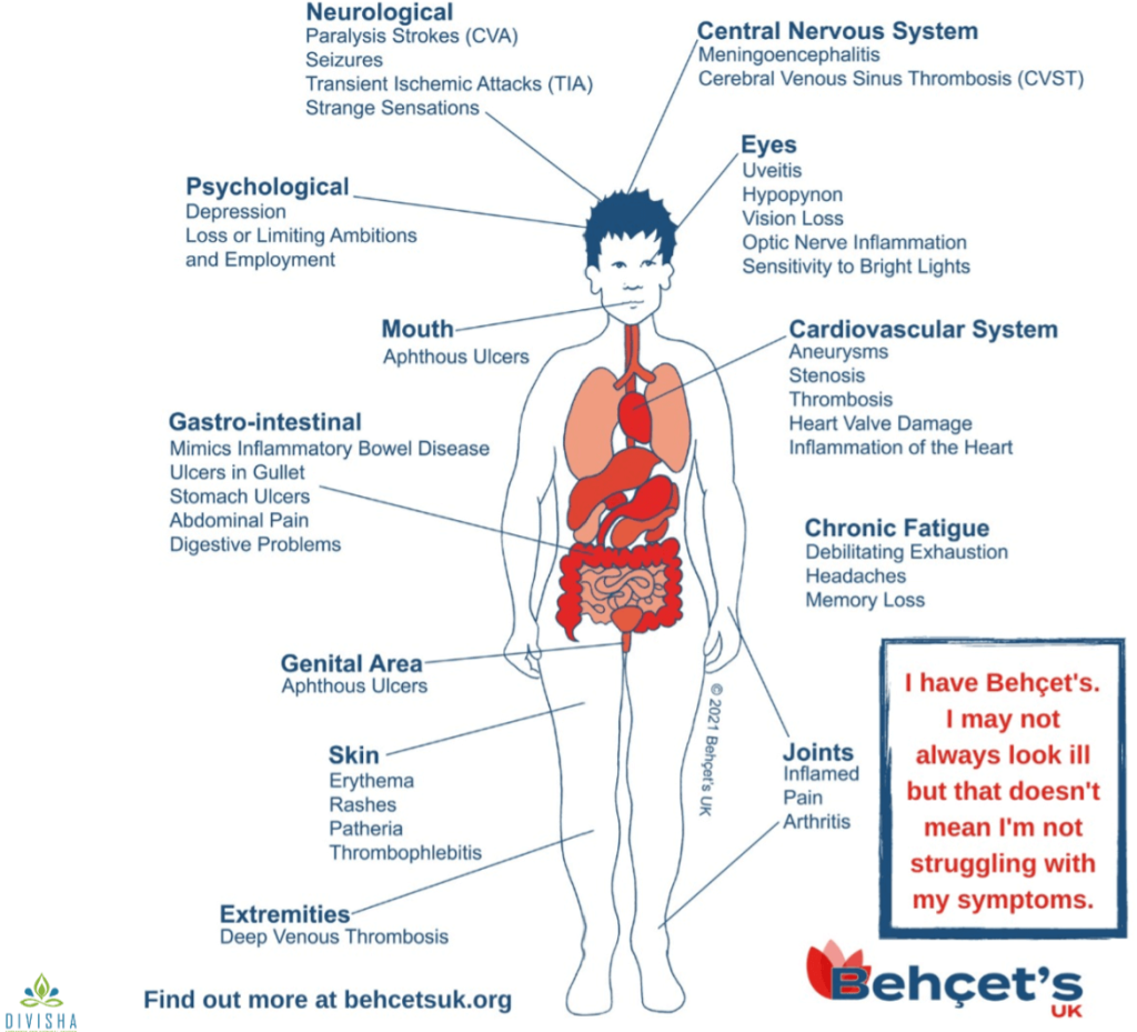 Clinical Practice Pearls Physicians Need To Know In Rheumatology