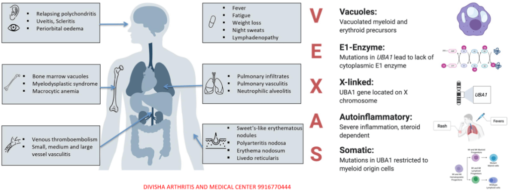 Clinical Practice Pearls Physicians Need To Know In Rheumatology