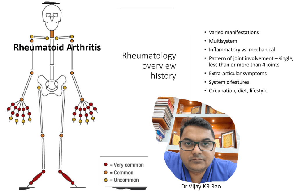 Clinical Practice Pearls Physicians Need To Know In Rheumatology