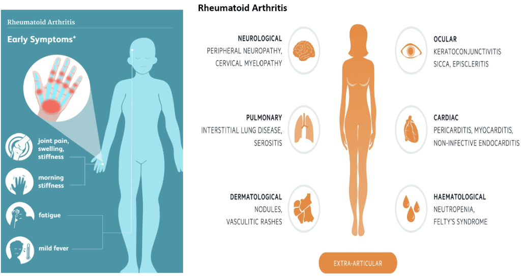 Clinical Practice Pearls Physicians Need To Know In Rheumatology