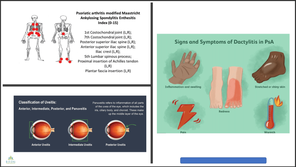 Clinical Practice Pearls Physicians Need To Know In Rheumatology
