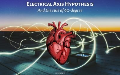Electrical axis hypothesis and the rule of 90-degree