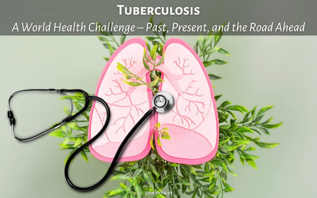 Tuberculosis: A World Health Challenge – Past, Present, and the Road Ahead
