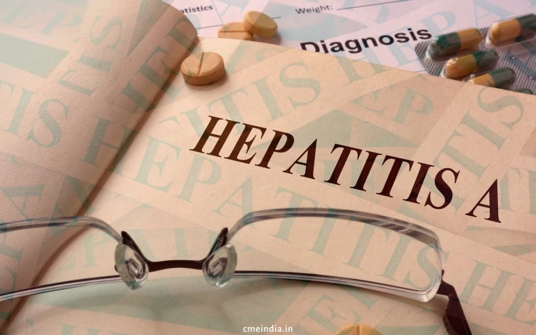 11-Year-Old Male Child with Highest Documented Levels of Serum Bilirubin 65 Mg/Dl
