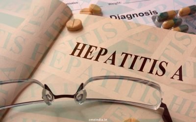 11-Year-Old Male Child with Highest Documented Levels of Serum Bilirubin 65 mg/dl