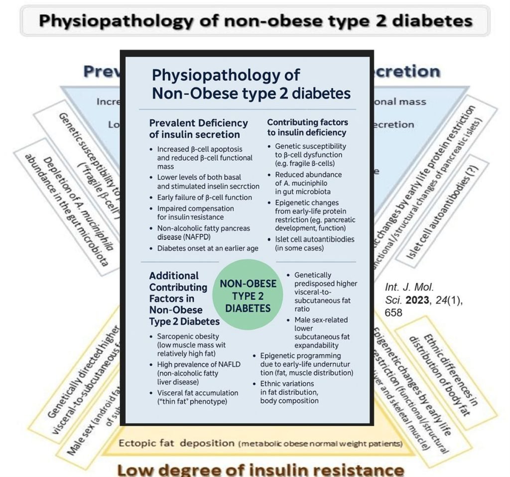 Lean Diabetes - What Physicians Must Know?