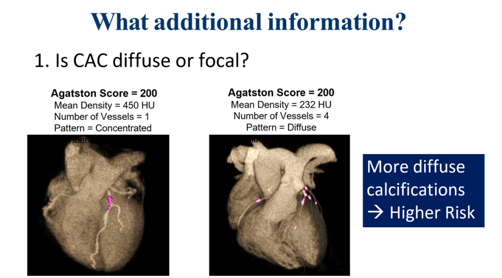 What should I do with a CAC score of 400in my Asymptomatic patient?