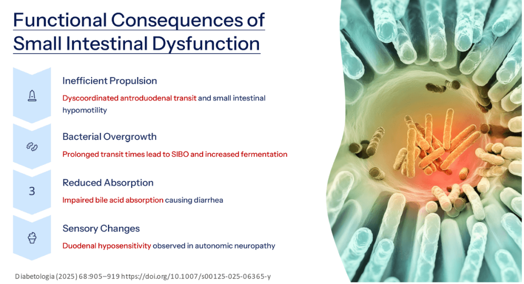 Diabetic Gastroenteropathy: A Pan-Alimentary Complication
