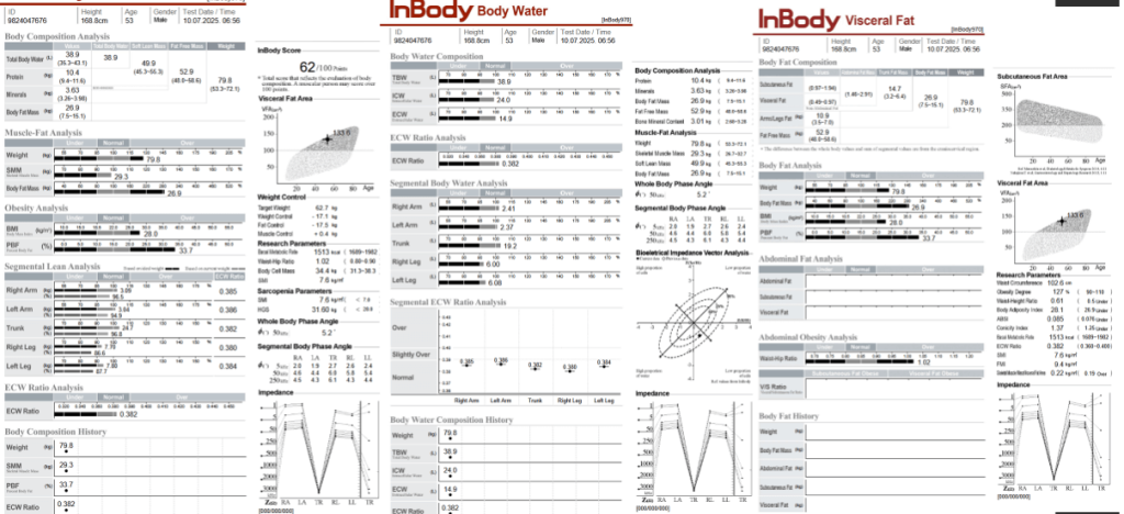 BMI is Not Enough: Lessons from the Saboo-Nawaria Paradox on Assessing Obesity in South Asians