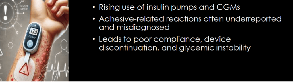 Allergy in Diabetes - What Physicians Must Know?