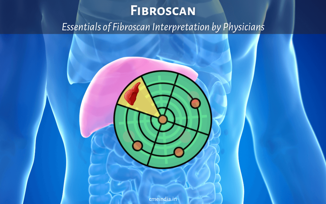 Essentials of Fibroscan Interpretation by Physicians