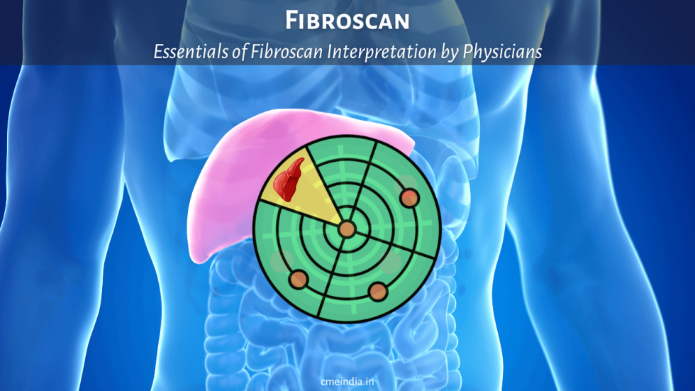 Essentials of Fibroscan Interpretation by Physicians