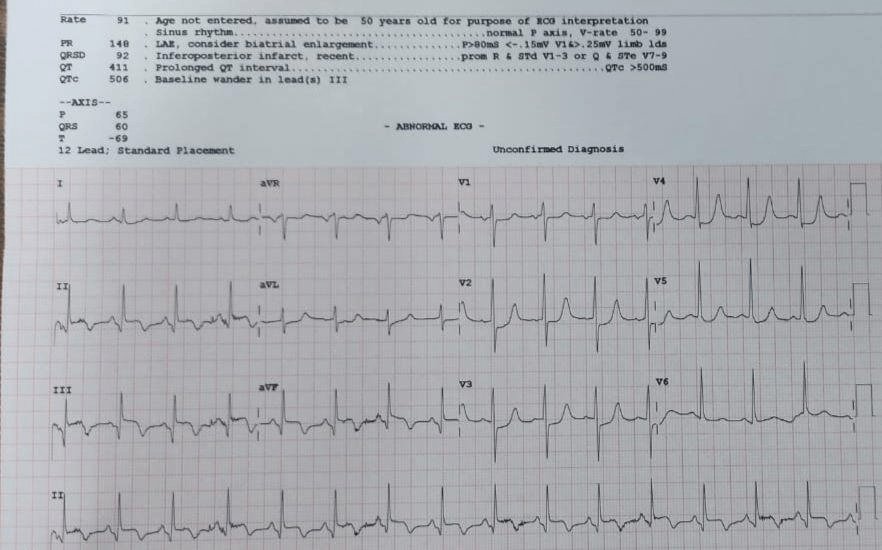When the ECG Whispers: Hidden Cardiac Emergencies in Diabetes Unmasked