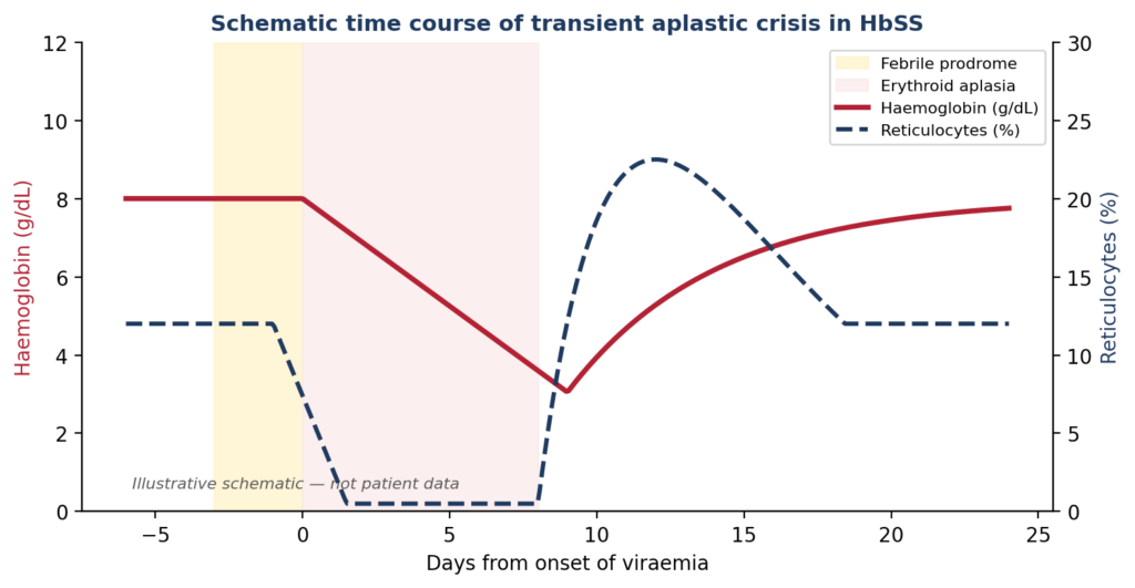 Sudden Severe Anaemia in a Young Adult with Sickle Cell Disease: Parvovirus B19–Associated Transient Aplastic Crisis